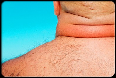 Zdroj: emedicinehealth.com