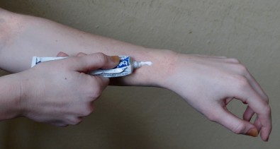 Ekzém, Foto: Nikola Liptáková, Topzine.cz