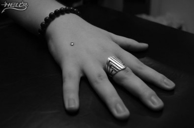 Mikrodermál lze aplikovat téměř kamkoli na těle, Zdroj: hell.cz