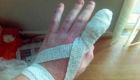 FOTO: Oštřená řezná rána