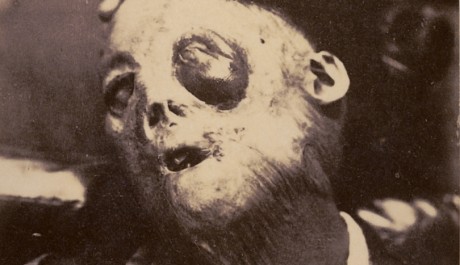 FOTO: Japonské lékařské fotografie kolem roku 1900