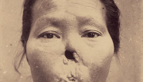 FOTO: Japonské lékařské fotografie kolem roku 1900