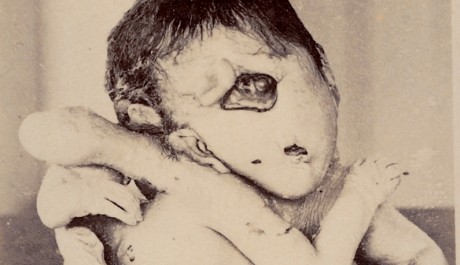 FOTO: Japonské lékařské fotografie kolem roku 1900