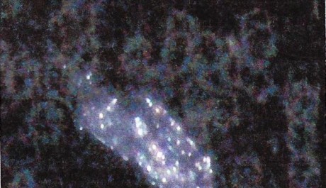 Foto: Krevn&iacute; obraz - pl&iacute;seň s těžk&yacute;mi kovy