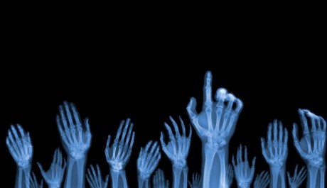 FOTO: Nick Veasey hands