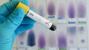 Princ Harry podstoupil test na HIV