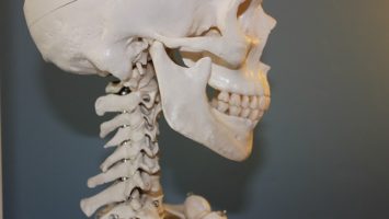 priznaky-ridnuti-kosti-osteoporozy