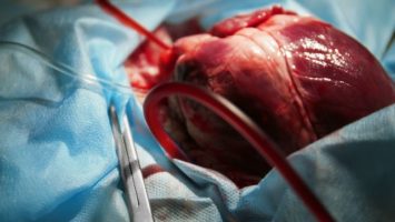 transplantace-srdce