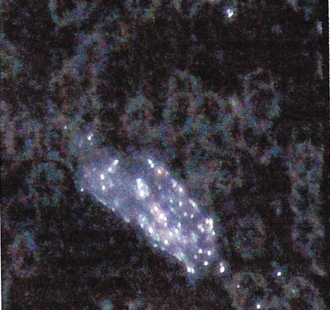 Foto: Krevní obraz - plíseň s těžkými kovy