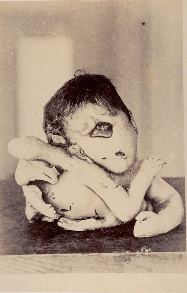 FOTO: Japonské lékařské fotografie kolem roku 1900