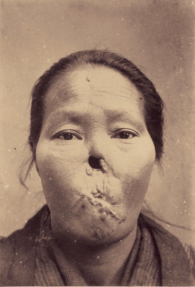 FOTO: Japonské lékařské fotografie kolem roku 1900