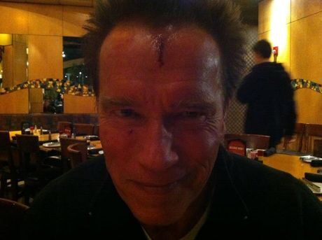 FOTO: Arnold Schwarzenegger si rozbil čelo