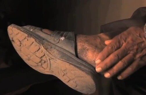 FOTO: Noha nejsmardlavějšího Inda