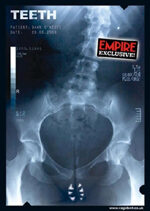 FOTO: Intimni tajemstvi