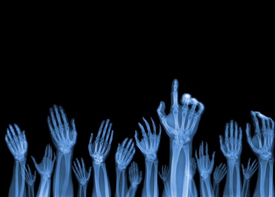 FOTO: Nick Veasey hands