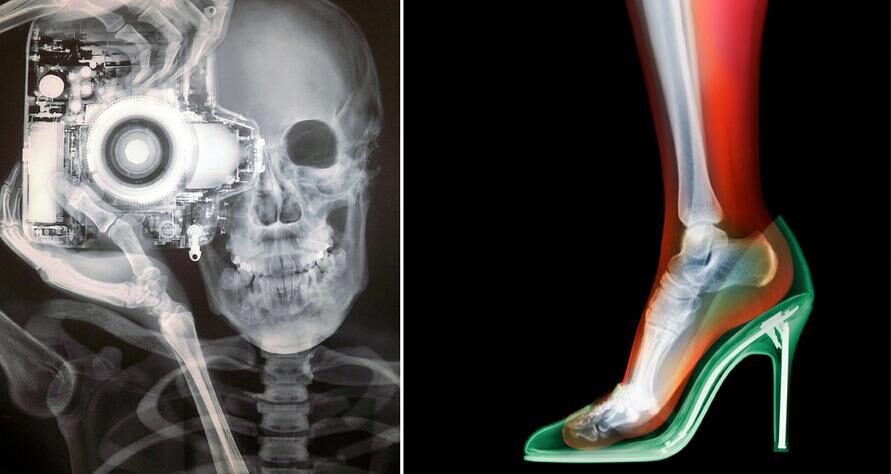 FOTO: Nick Veasey ukazka tvorby