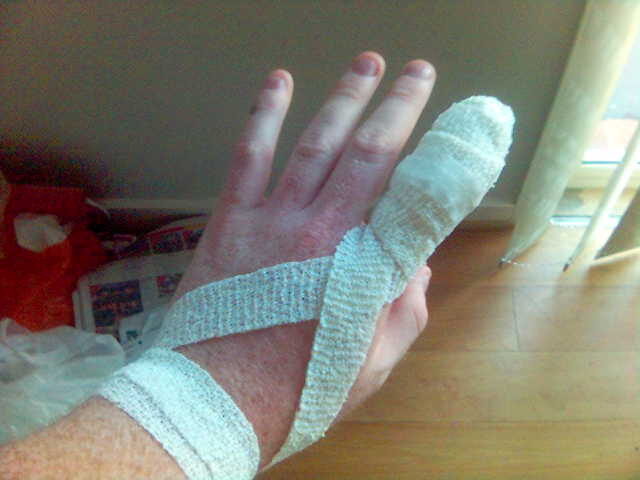 FOTO: Oštřená řezná rána